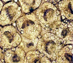 Photo de protoscolex d’Echinococcus multilocularis