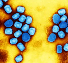 Bright blue rectangular virus particles against a yellow background