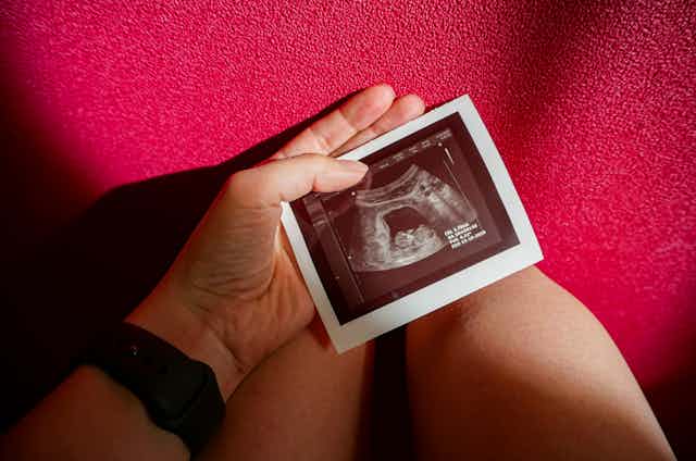 hand holds pregnancy ultrasound print out