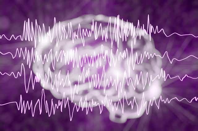 An illustration of chaotic EEG brain waves against a background depicting an image of the human brain.
