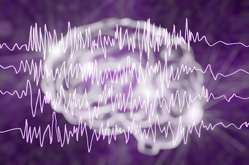 Silent, subtle and unseen: How seizures happen and why they're hard to diagnose