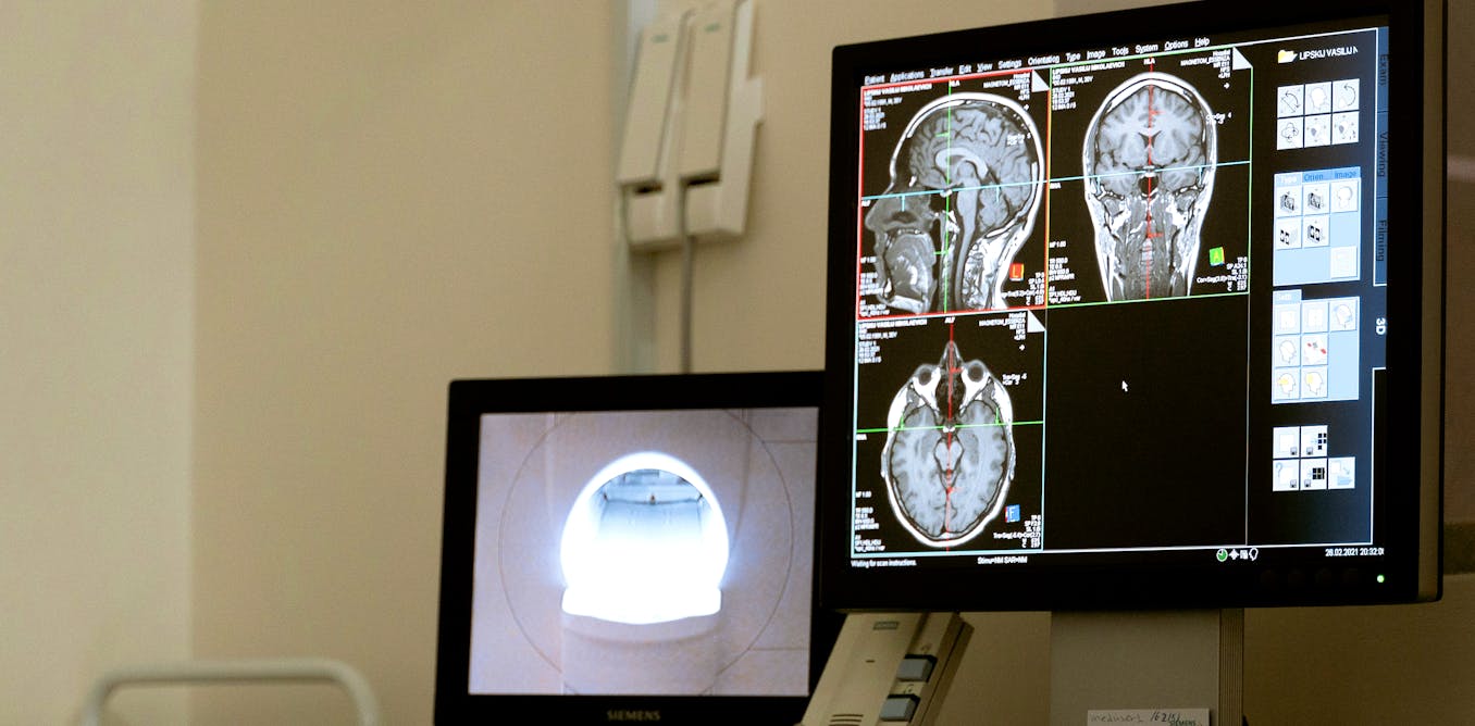 Radiologie : pourquoi l’IA n’a (toujours) pas remplacé le médecin