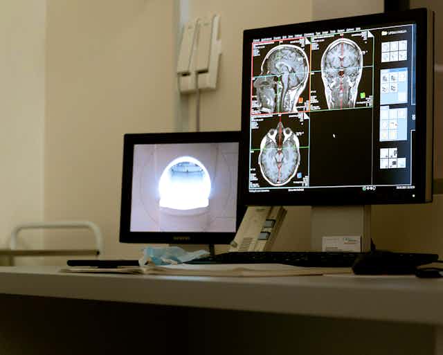 Des clichés de radiographie d'un crâne apparaissent sur un écran d'ordinateur devant lequel il n'y a pas d'opérateur