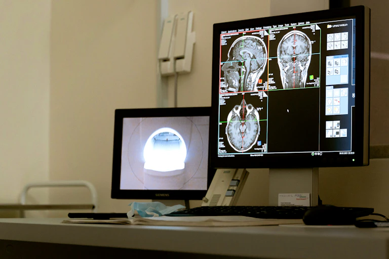 Des clichés de radiographie d'un crâne apparaissent sur un écran d'ordinateur devant lequel il n'y a pas d'opérateur