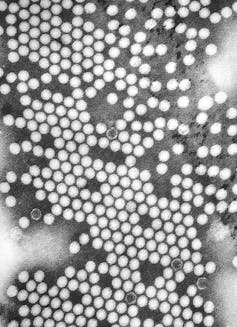 A close up view of the poliovirus.