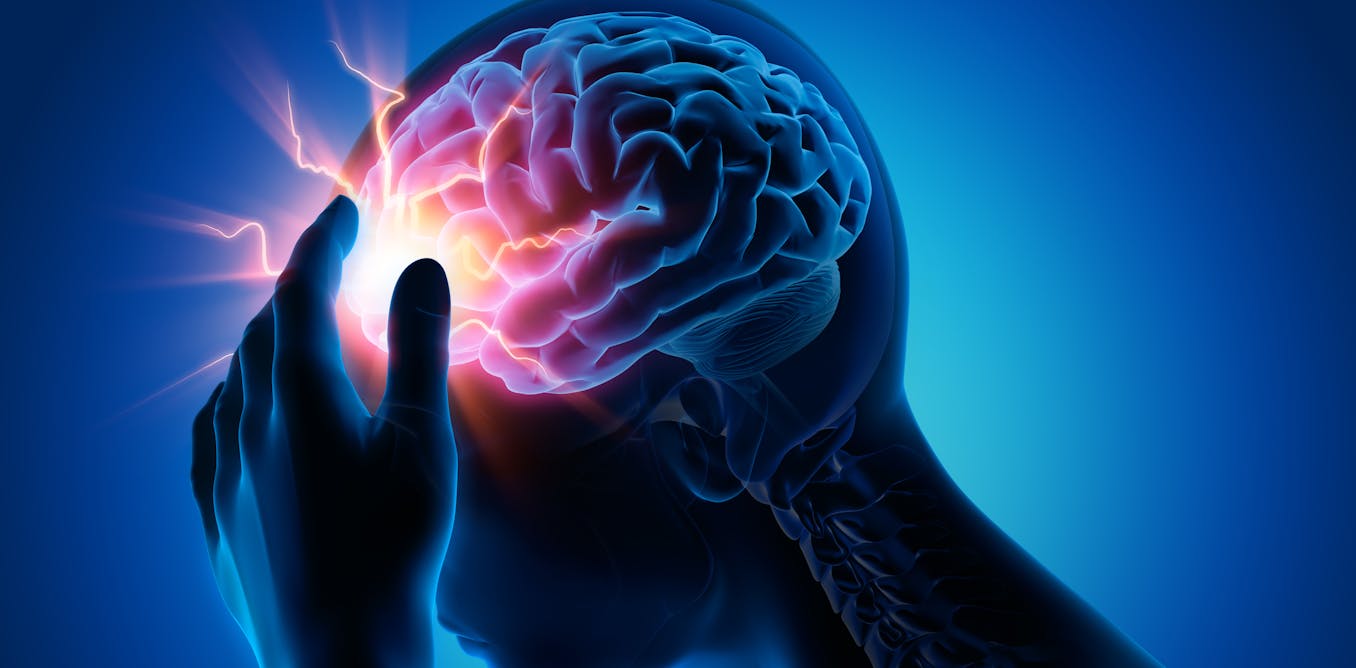 Migraine sufferers have treatment choices – a neurologist explains options beyond just pain medication