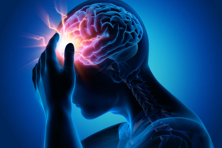 A medical illustration of a migraine, showing the outline of a man's head and upper body; a portion of the brain is lit up to depict pain.