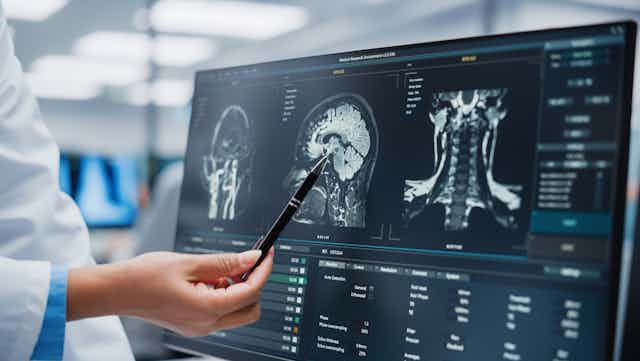 Una persona con bata señala con un bolígrafo una pantalla que muestra la radiografía de un cerebro de perfil.