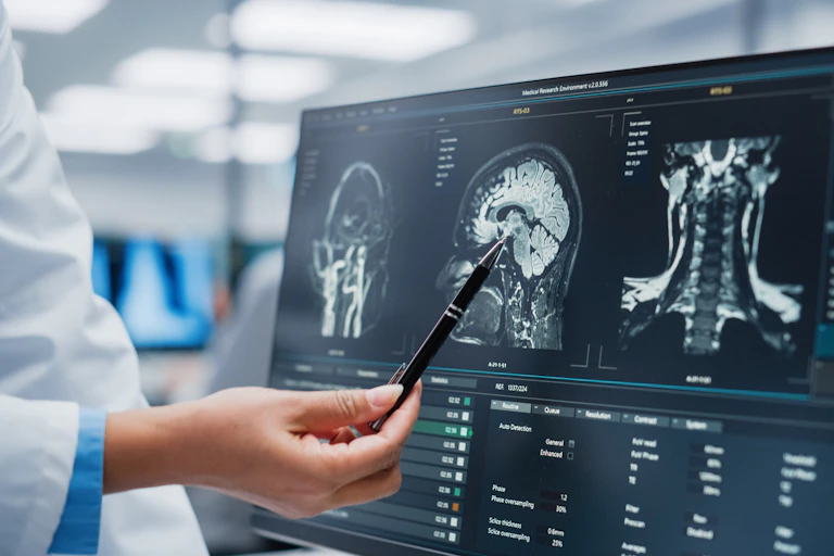 Una persona con bata señala con un bolígrafo una pantalla que muestra la radiografía de un cerebro de perfil.