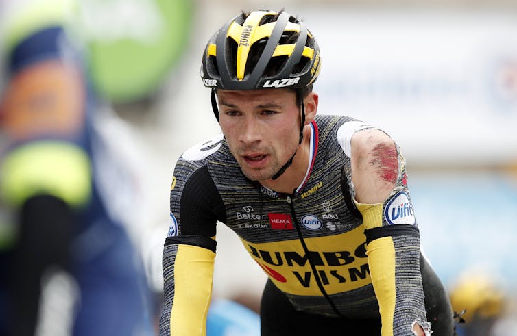 Man in cycle kit with visible shoulder injury