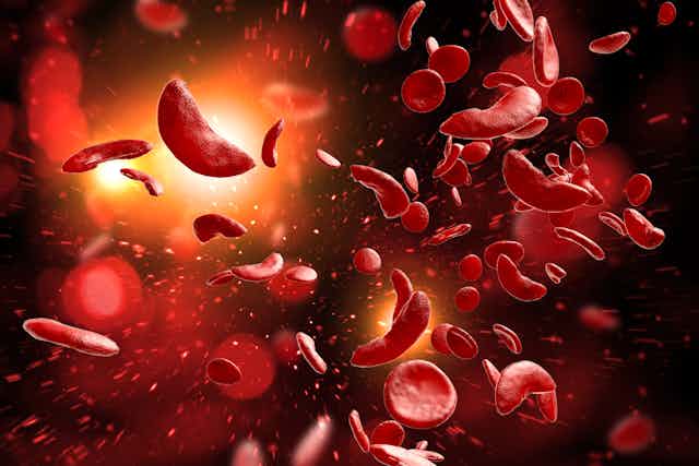 Sickle cell disease blood cells 3D illustration