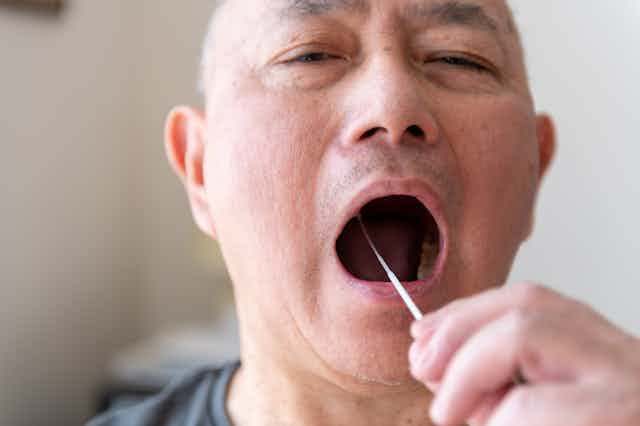 Man with throat swab in his mouth
