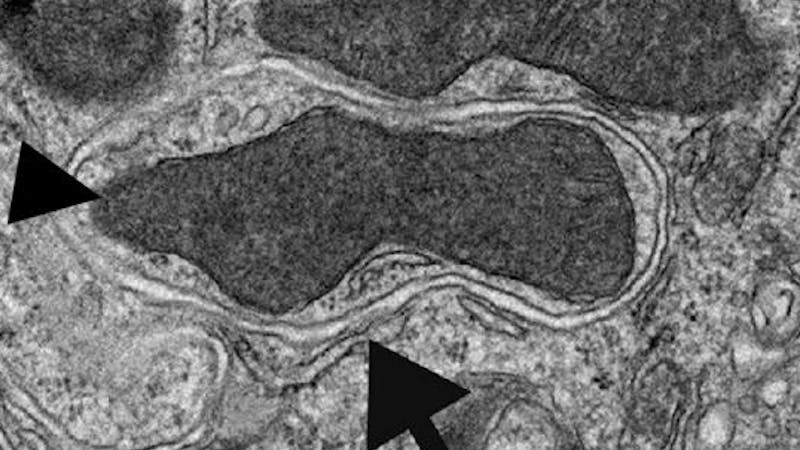 Si ayunamos, las células reciclan: así funciona la autofagia Si ayunamos, las células reciclan: así funciona la autofagia