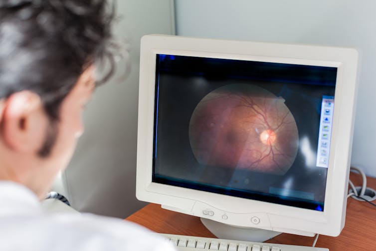 An optometrist examines a retinal photograph on a computer screen.