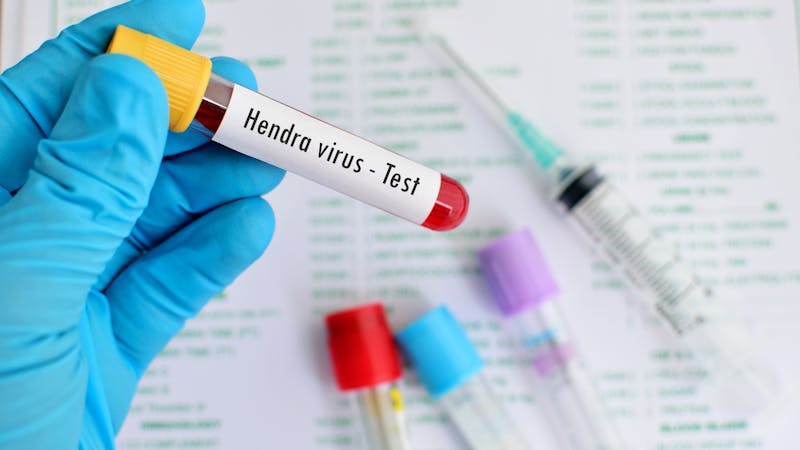 Regresa el letal virus Hendra Regresa el letal virus Hendra