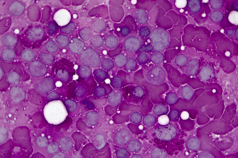 Light micrograph of red bone marrow at 100x magnification