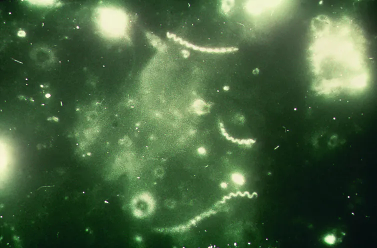microscopic image of long white worm-like shapes