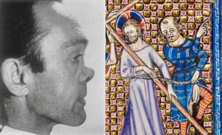 Side view of man with a collapsed nose, paired with medieval painting of Jesus and a persecutor