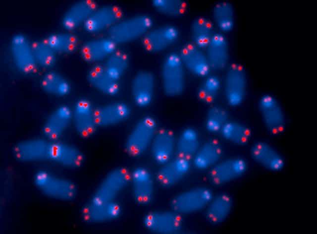 Microscopy image of chromosomes, with the telomeres stand red.