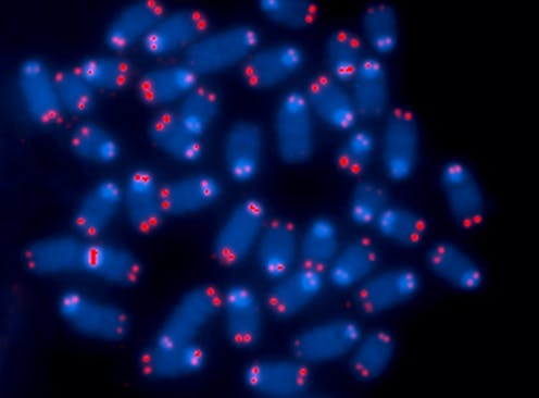 Cells become zombies when the ends of their chromosomes are damaged – a tactic both helpful and harmful for health