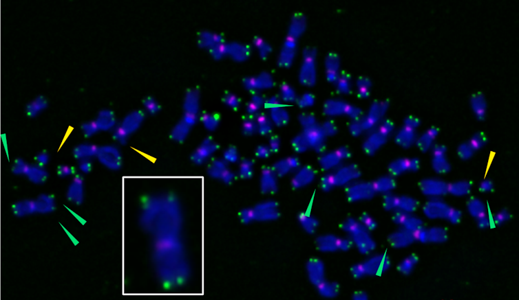 Microscopy image of chromosomes with telomeres damaged by oxidation
