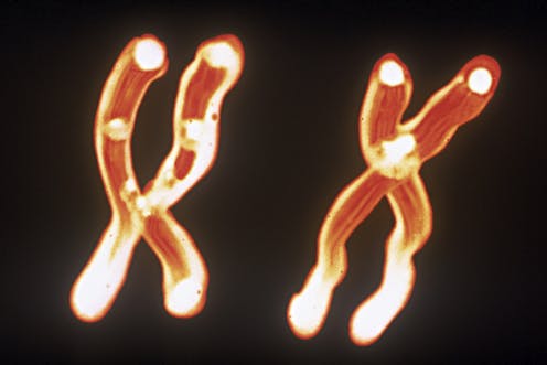 Y chromosome loss through aging can lead to an increased risk of heart failure and death from cardiovascular disease, new research finds