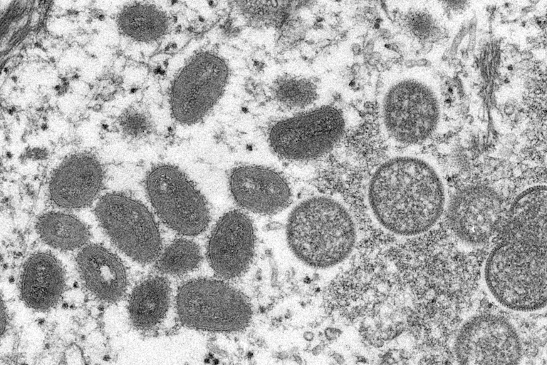 A black and white image showing ovals
