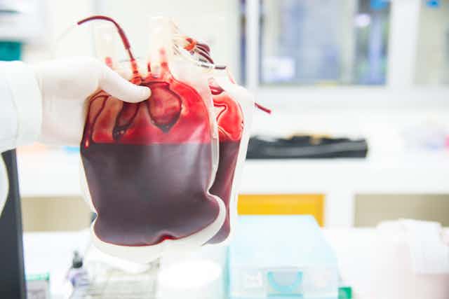 A gloved hand holds two bags of blood.