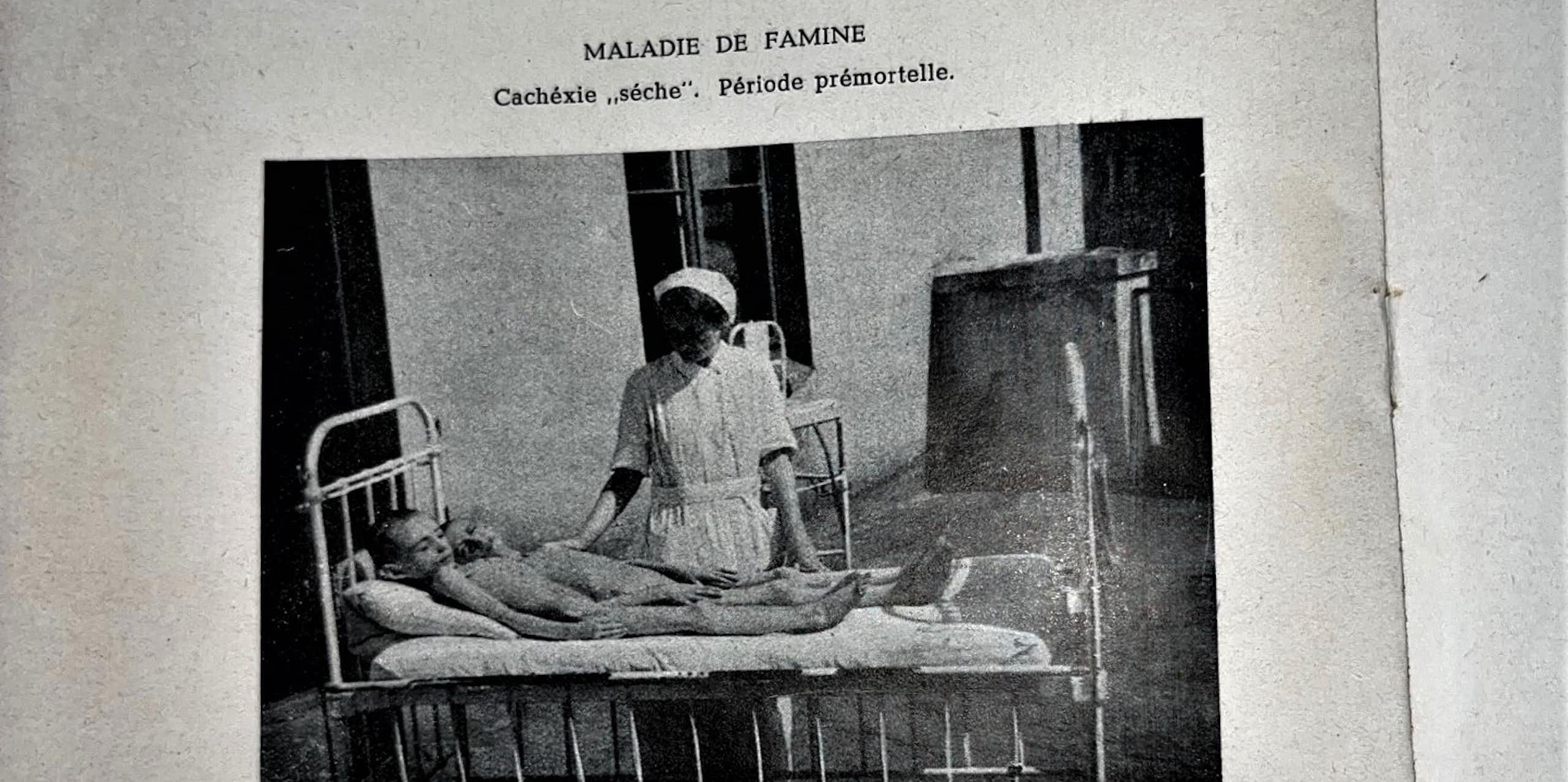 nurse stands over a bed with two naked emaciated children in it