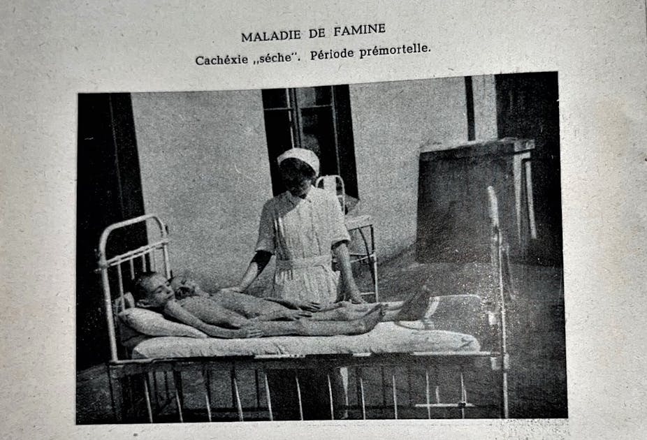 nurse stands over a bed with two naked emaciated children in it