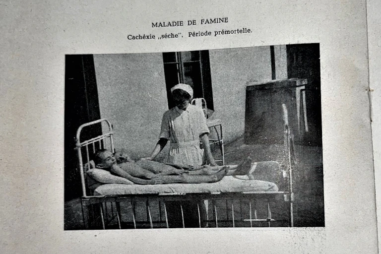 nurse stands over a bed with two naked emaciated children in it