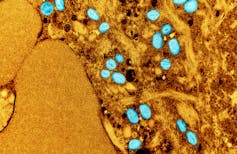 Microscopic, colourized image of teal, oval-shaped monkeypox virus particles against an amber background