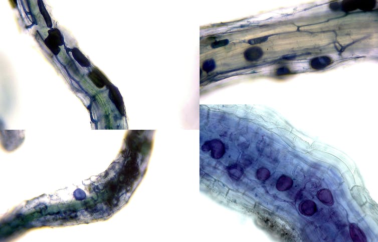 Microscope images of fungi inside plant roots.