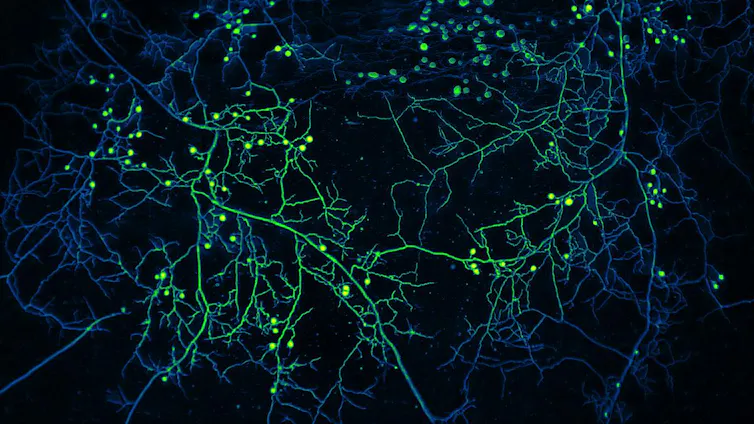 Image of a fungal network in the soil.