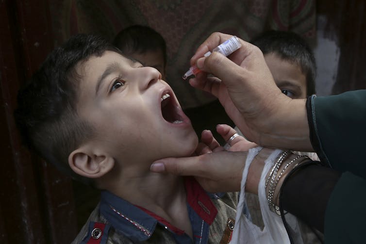adult hands administer a drop of medicine to a boy with open mouth