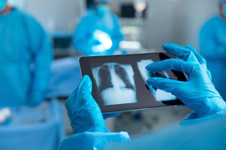 A doctor looking at an X-ray of lungs on a tablet computer.