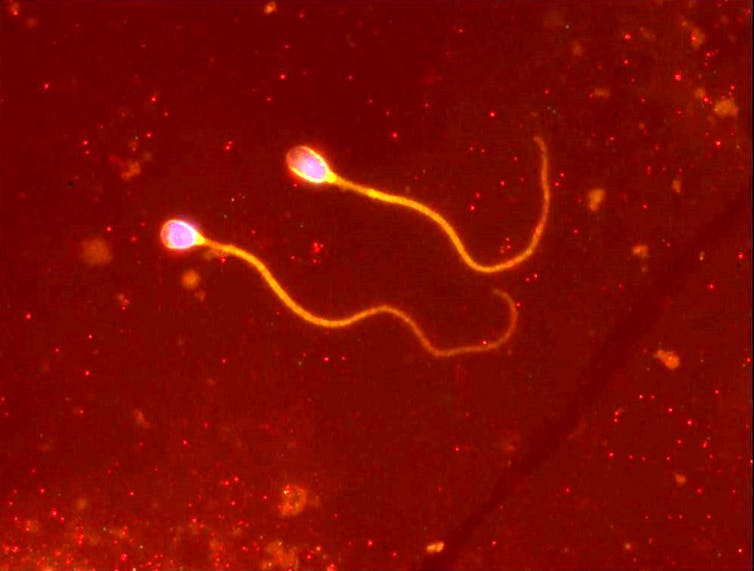 Deux spermatozoïdes sont côte à côte