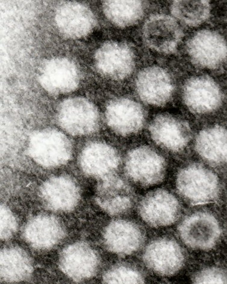 Virus adenoasociado: ¿quién es este nuevo sospechoso en las hepatitis infantiles de origen desconocido?