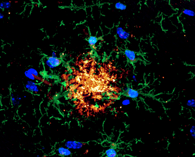 microscopic image of brain cells