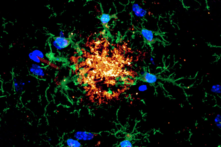 microscopic image of brain cells