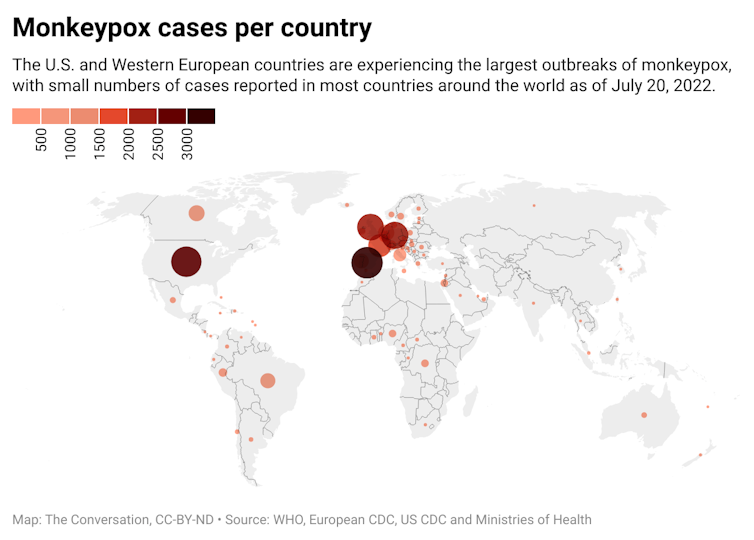 A map of the world with circles over various countries representing the number of cases of monkeypox per country.
