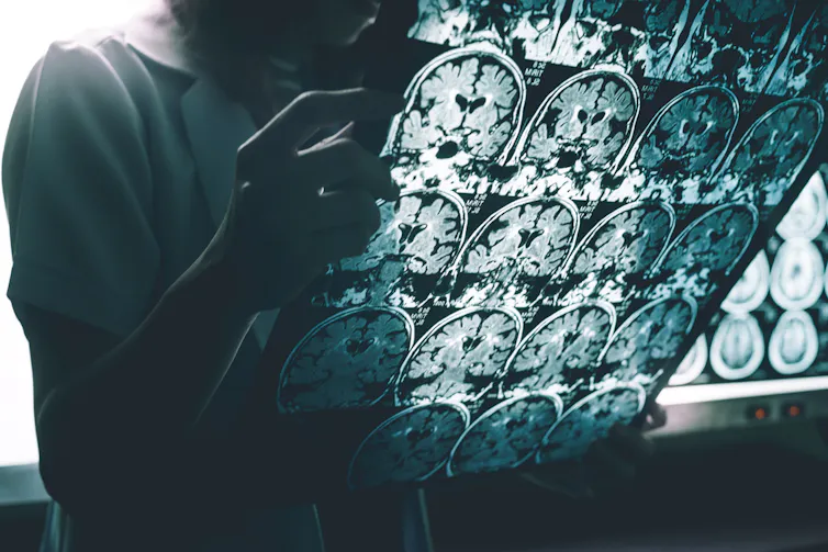 femme regarde des radiographies de cerveau (IRM)