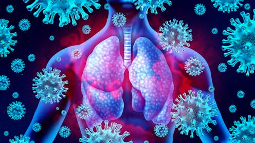 Long COVID-19 and other chronic respiratory conditions after viral infections may stem from an overactive immune response in the lungs