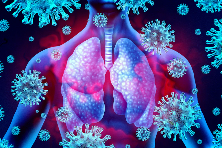Illustration of a person's lungs glowing red, surrounded by viruses