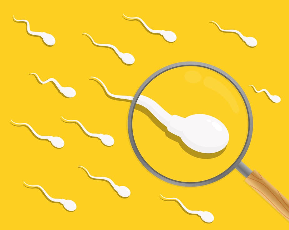 An illustration of sperm on a yellow background, with a magnifying glass zooming in on one of them.