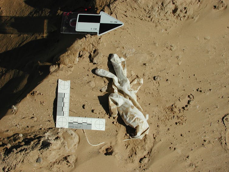 Dirty medical gloves are seen covered in dirt and measured with a L shaped tool and an arrow.