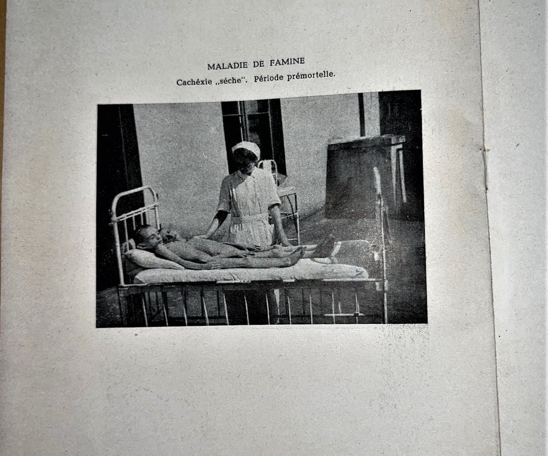 Médicos judíos del gueto de Varsovia documentaron en secreto los efectos de  las políticas nazis de hambruna en un libro redescubierto recientemente