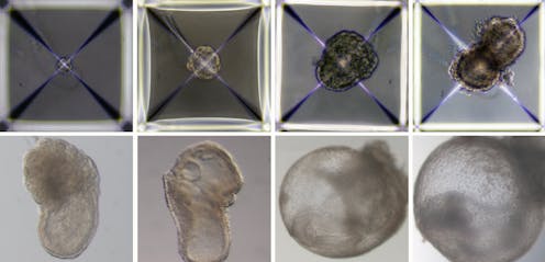 World's first 'synthetic embryo': why this research is more important than you think
