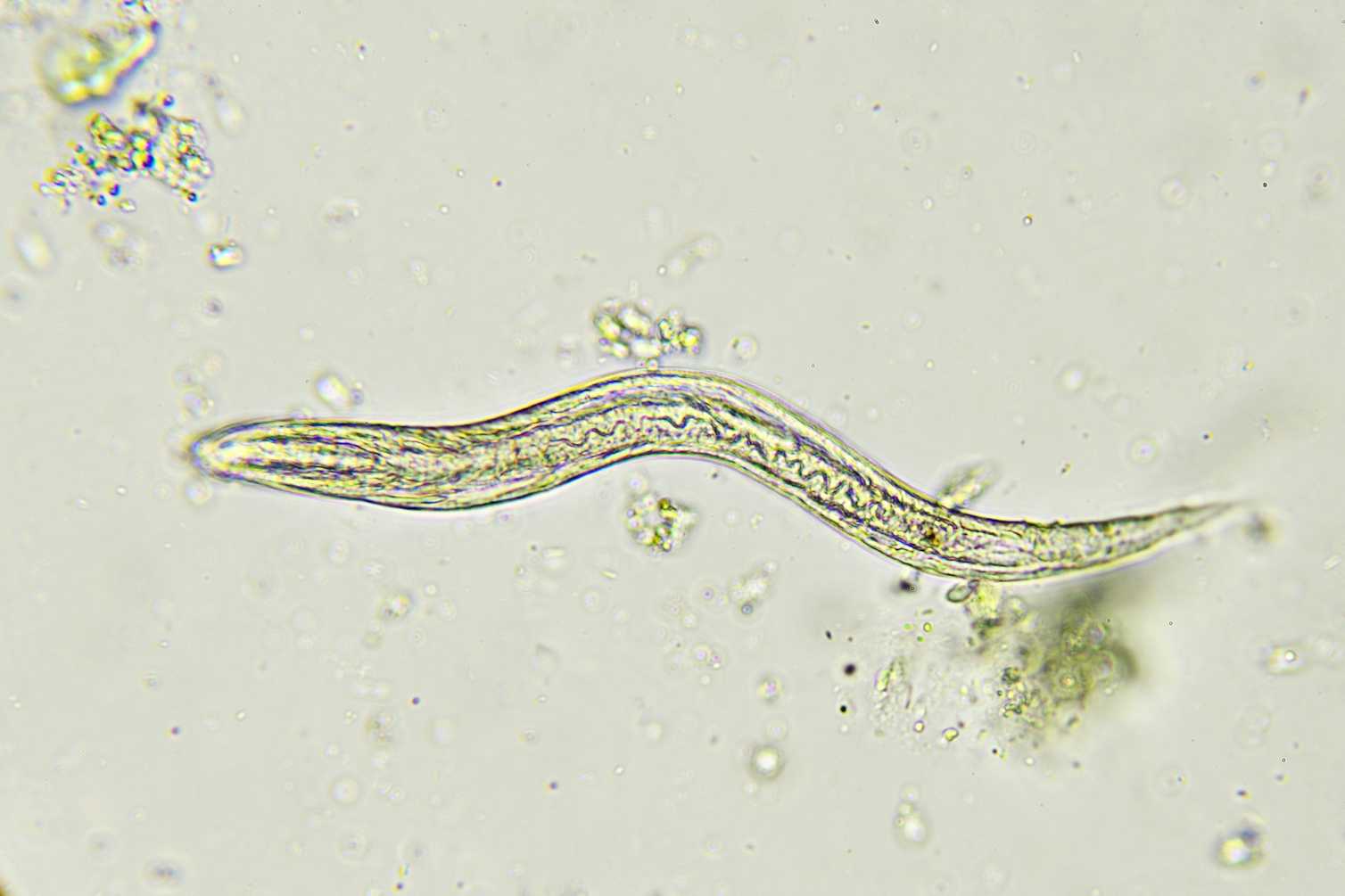 Strongyloides личинки