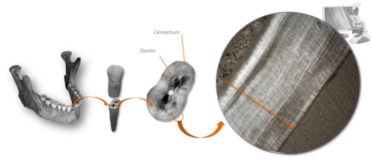 Kieferknochen mit Zähnen, ein Zahn und eine mikroskopische Ansicht von Schichten im Zement eines Zahns